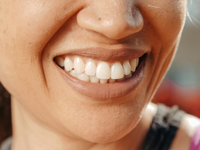 older woman with implants smiling